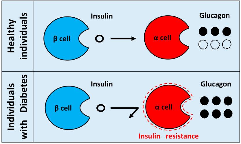 سندروم مقاومت به انسولین 1